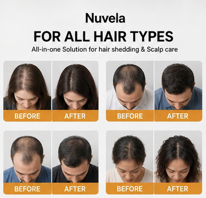 Nuvela™ Hair Growth Serum + Soothing Massage Brush